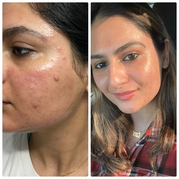 Collagen Night Wrapping Peel Off Mask (Buy 1 Get 1)